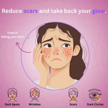 Skinblizz Silicone Scar Tape
