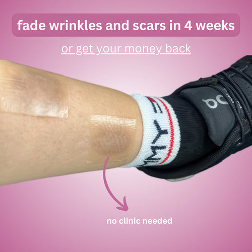 Skinblizz Silicone Scar Tape